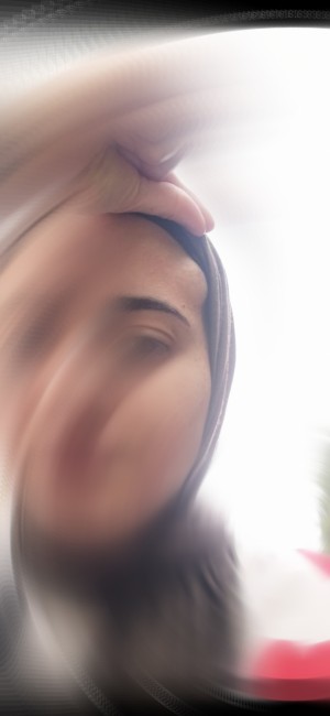 Lavinia Güzellik Merkezi Yüzüm Yandı Ve Şişti